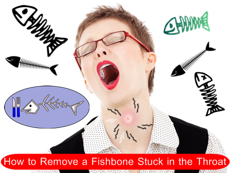 ก้างปลาติดคอ How to Remove a Fishbone Stuck in the Throat